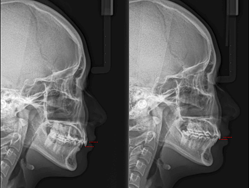 揚起下顎 翻轉人生