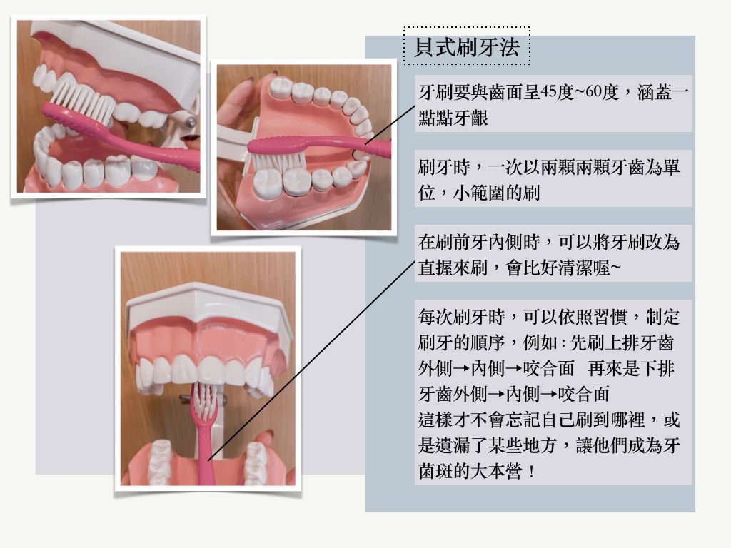 每天刷牙為何蛀牙還會找上門？