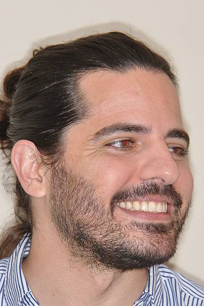 上顎全齒列後移 改善深咬/暴牙/二級咬合 (HPPG technique)